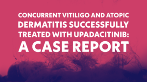 Vitiligo • Dermatite Atópica • Upadacitinibe o novo trio da dermatologia