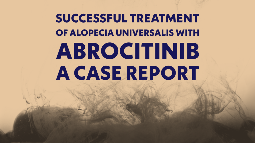 Abrocitinibe no tratamento da alopecia universal